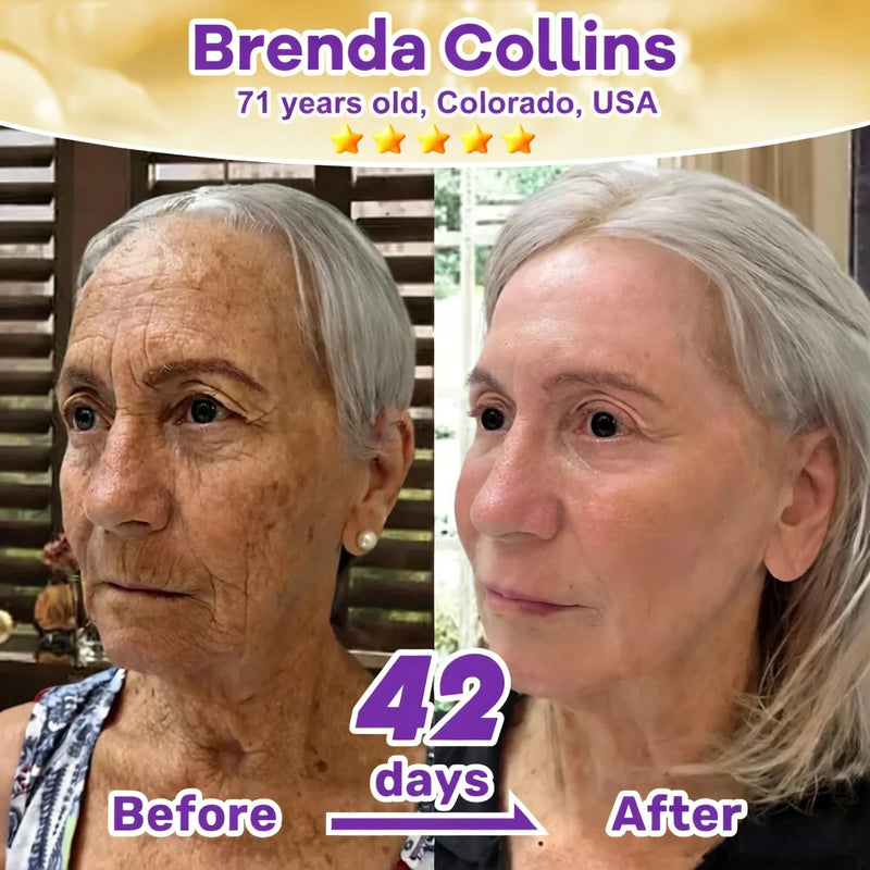 SkinRevive – Crema Restauradora de Piel 10 en 1 con Biotina