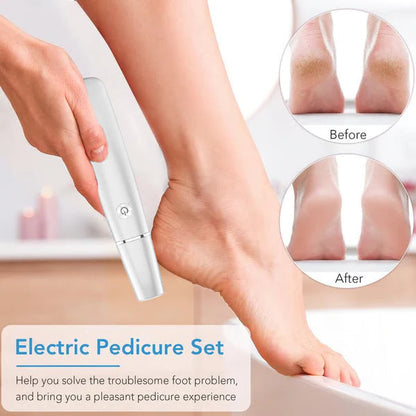 SoleSmooth - Removedor Eléctrico de Callos para Pies