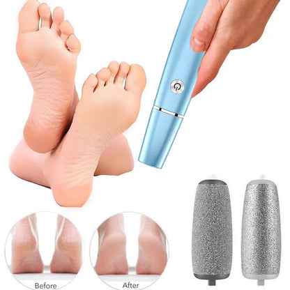 SoleSmooth - Removedor Eléctrico de Callos para Pies