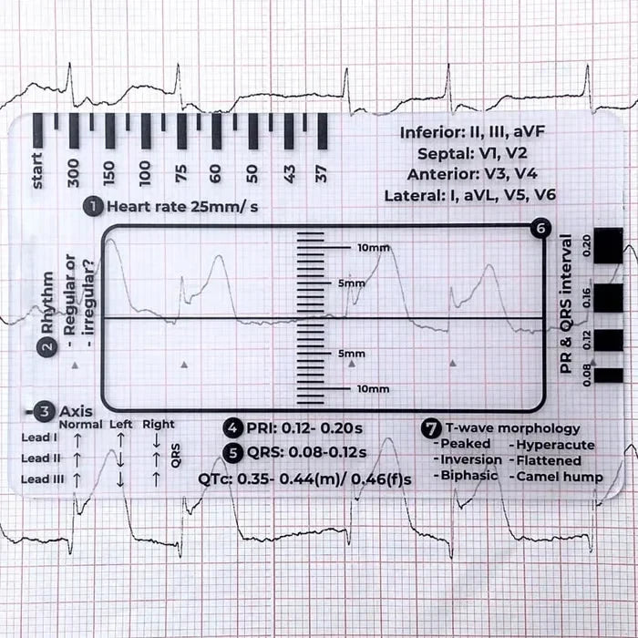 MediTrack – Guía de bolsillo para la evaluación profesional de ECG