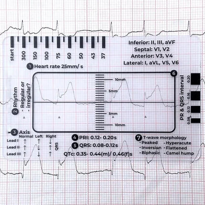 MediTrack – Guía de bolsillo para la evaluación profesional de ECG