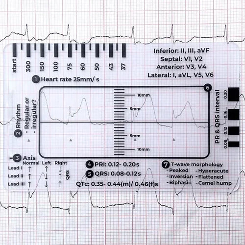 MediTrack – Guía de bolsillo para la evaluación profesional de ECG