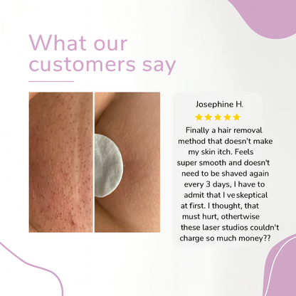 GlowEase - Depiladora IPL para una Piel Suave sin Esfuerzo