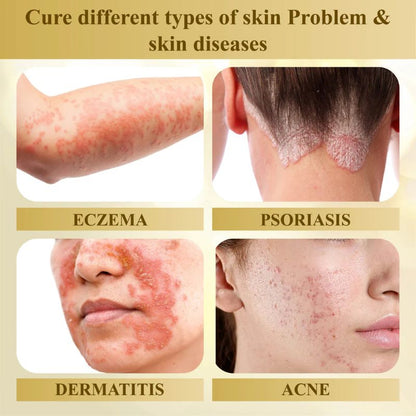DermaVenom – Crema reparadora avanzada para la piel