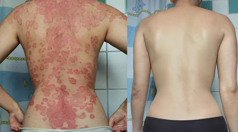 DermaCalm – Pulverizador botánico de magnesio