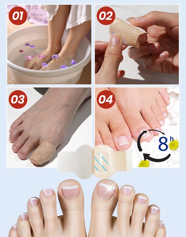 FungiCare – Fortschrittliche Nagelreparatur-Pflaster