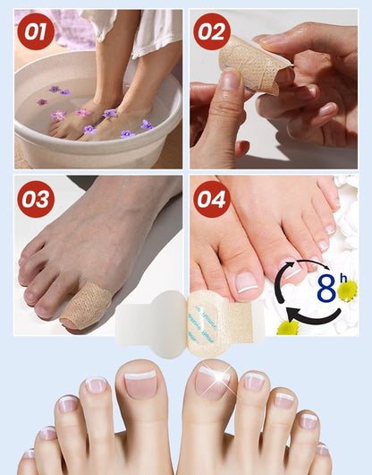FungiCare – Fortschrittliche Nagelreparatur-Pflaster