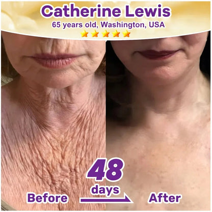 SkinRevive – Crema Restauradora de Piel 10 en 1 con Biotina