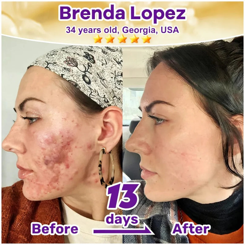SkinRevive – Crema Restauradora de Piel 10 en 1 con Biotina