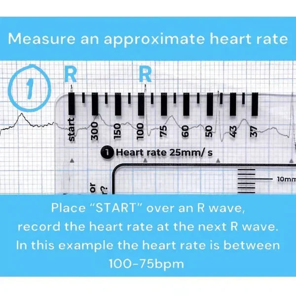 MediTrack – Guía de bolsillo para la evaluación profesional de ECG