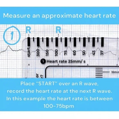 MediTrack – Guía de bolsillo para la evaluación profesional de ECG