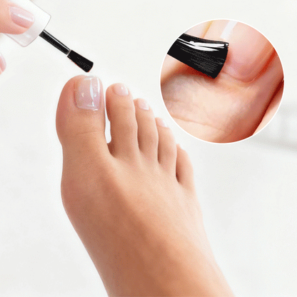 VitaNail – Intensiv-Stift gegen Nagelpilz
