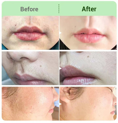 DermaSilk – Crema capilar para piel sensible