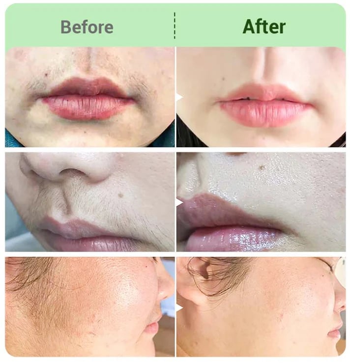 SkinEase – Crema Depilatoria de Acabado Suave