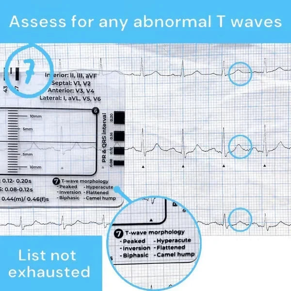MediTrack – Guía de bolsillo para la evaluación profesional de ECG