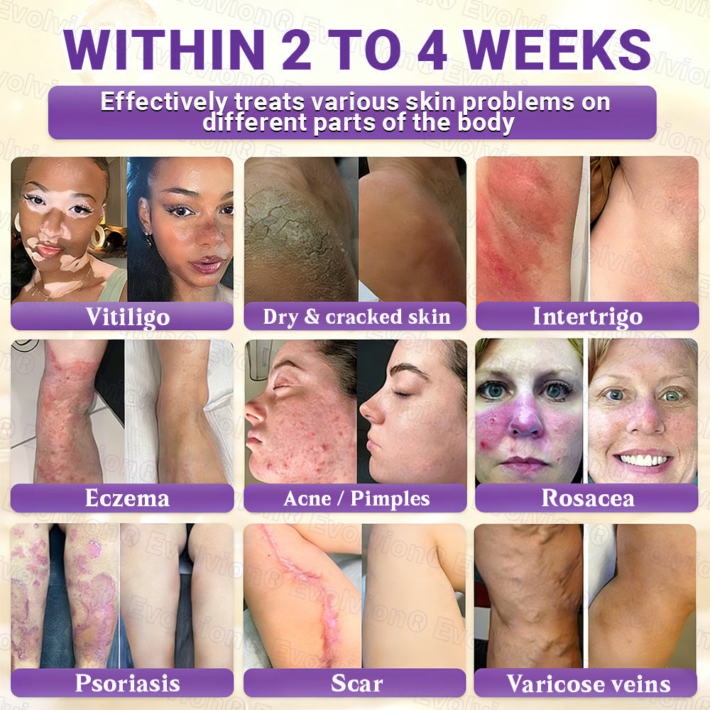 DermaVive – Biotin 10-in-1 Hauterneuerungscreme