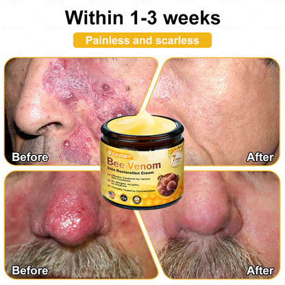 BeeLuxe – Crema facial reafirmante de veneno de abeja premium