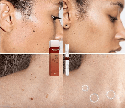 ClearGuard – Lápiz eficaz para eliminar verrugas
