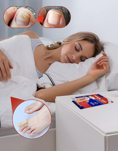 FungiCare – Fortschrittliche Nagelreparatur-Pflaster