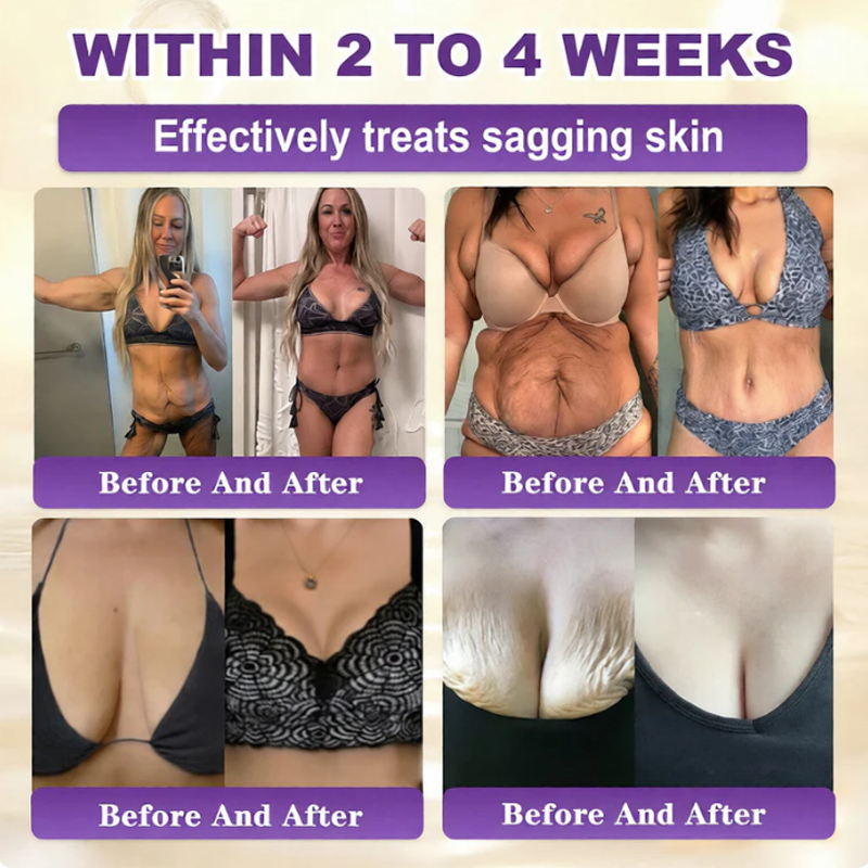 SkinRevive – Crema Restauradora de Piel 10 en 1 con Biotina