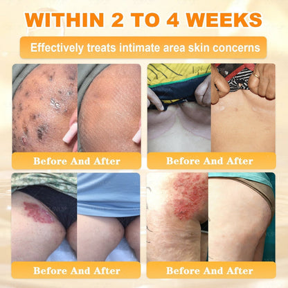 BeeLuxe – Crema facial reafirmante de veneno de abeja premium