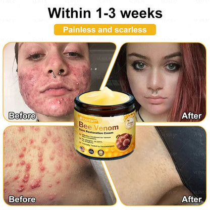 BeeLuxe – Crema facial reafirmante de veneno de abeja premium