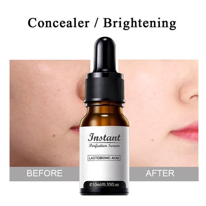 DermaYouth – Argireline Anti-Aging-Formel