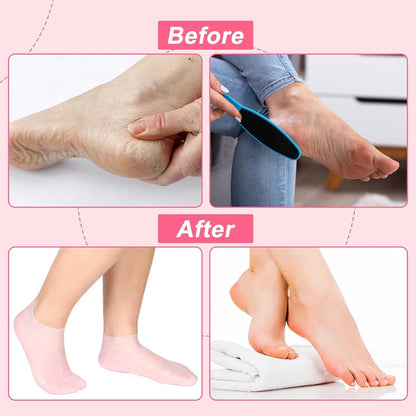 Calcetines VelvetHeel – Cuidado para pies de piel suave