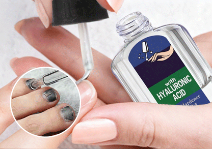 VitaNail – Intensiv-Stift gegen Nagelpilz