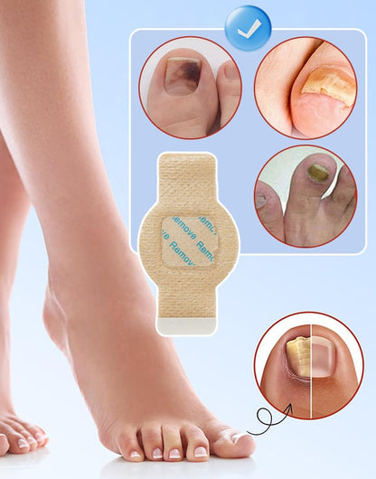 FungiCare – Fortschrittliche Nagelreparatur-Pflaster