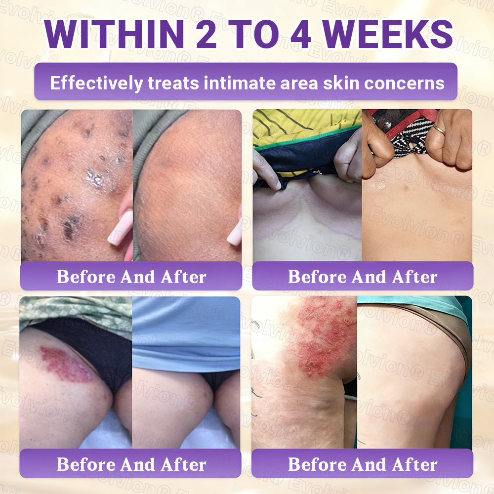 DermaVive – Biotin 10-in-1 Hauterneuerungscreme