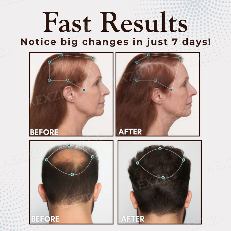 ThriveHair – Premium-Formel für Haarwachstum & Widerstandskraft