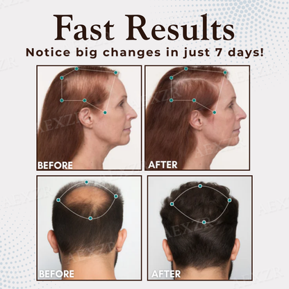 ThriveHair – Premium-Formel für Haarwachstum & Widerstandskraft