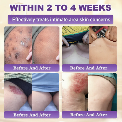 SkinRevive – Crema Restauradora de Piel 10 en 1 con Biotina