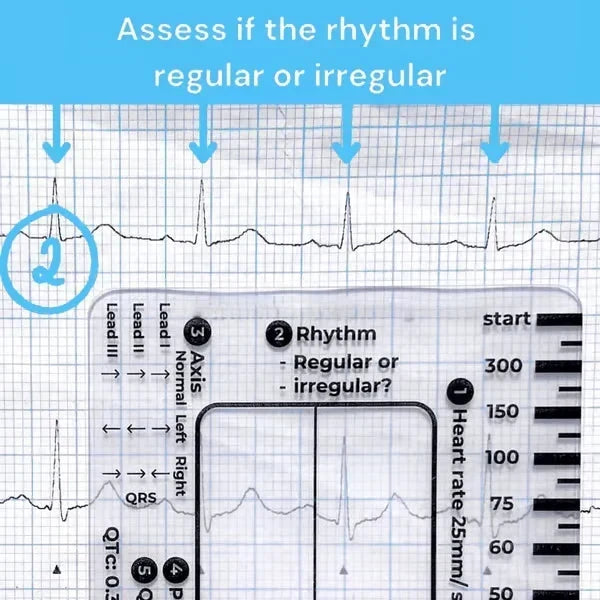 MediTrack – Guía de bolsillo para la evaluación profesional de ECG