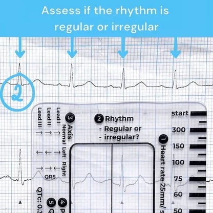 MediTrack – Guía de bolsillo para la evaluación profesional de ECG
