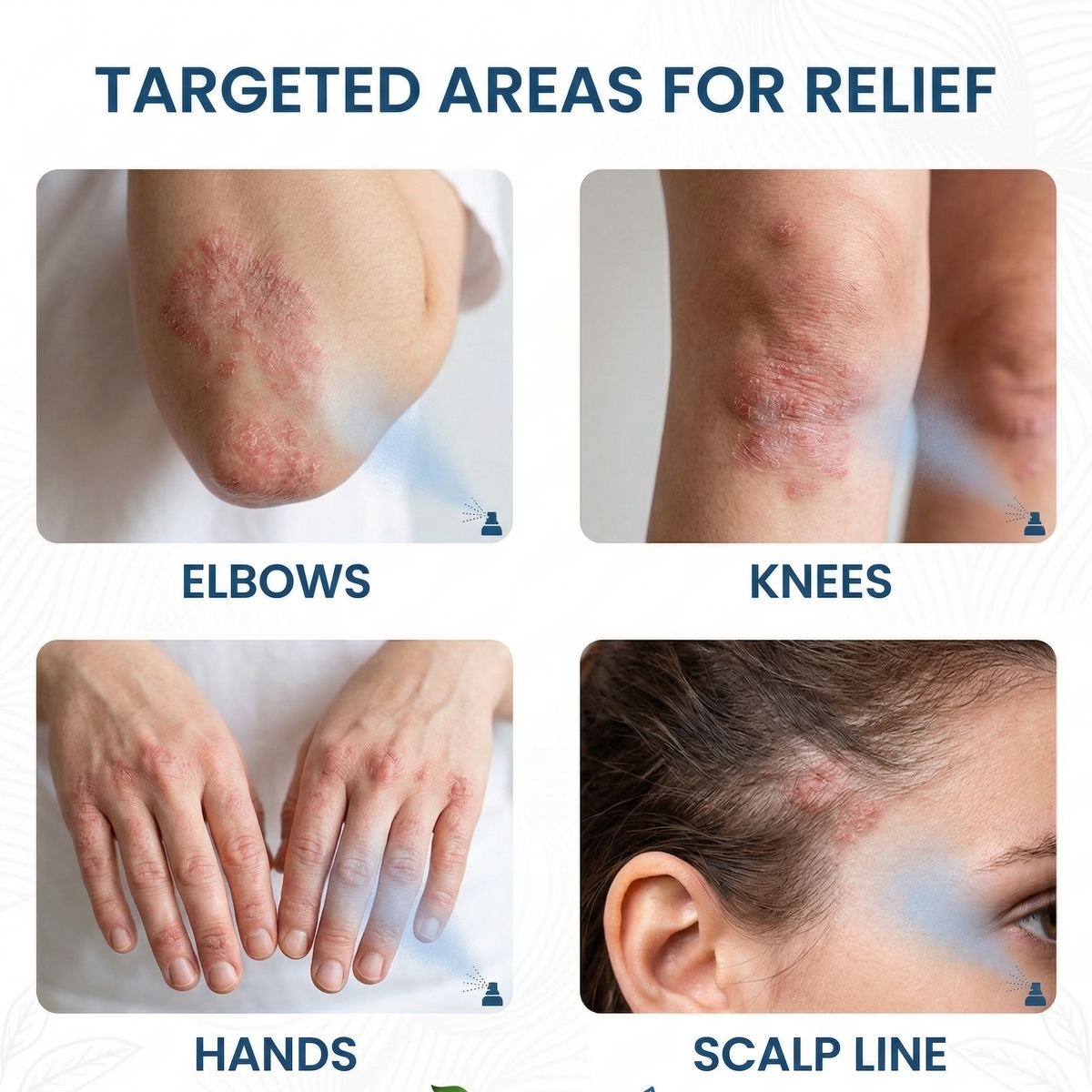 DermaCalm – Pulverizador botánico de magnesio