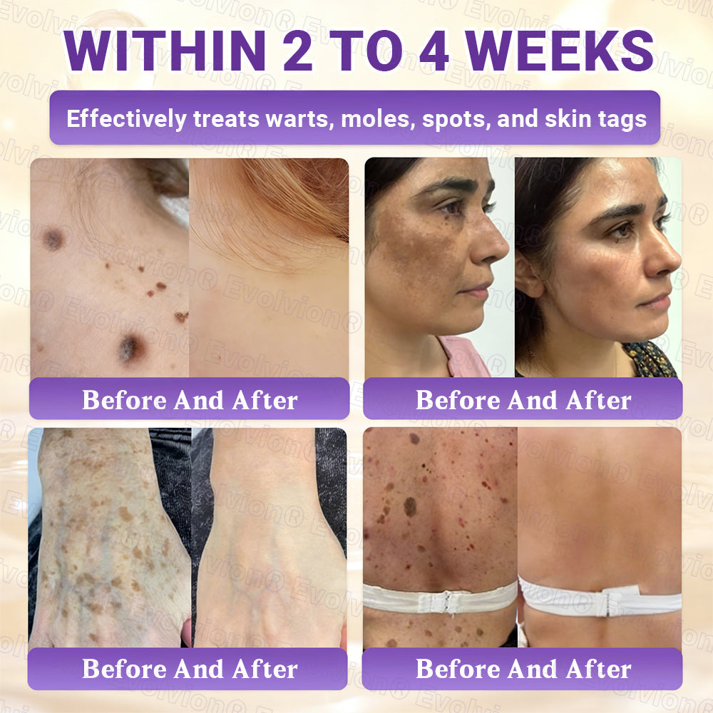 DermaVive – Biotin 10-in-1 Hauterneuerungscreme