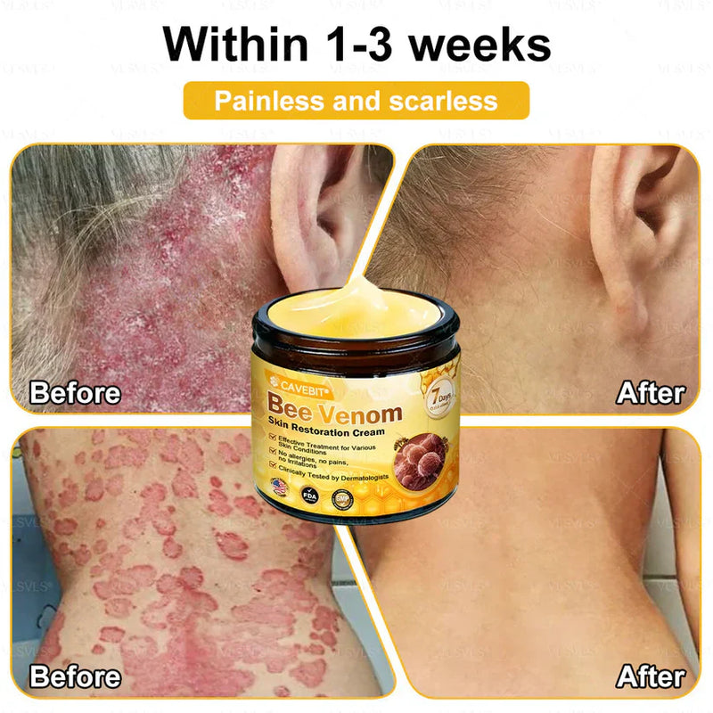 BeeLuxe – Crema facial reafirmante de veneno de abeja premium