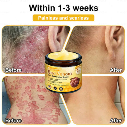 BeeLuxe – Crema facial reafirmante de veneno de abeja premium