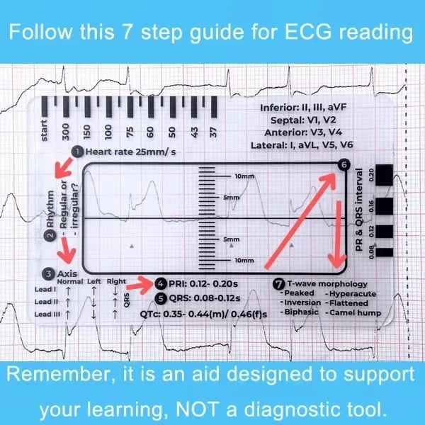 MediTrack – Guía de bolsillo para la evaluación profesional de ECG