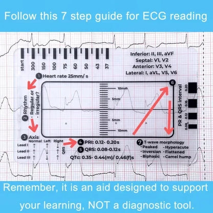 MediTrack – Guía de bolsillo para la evaluación profesional de ECG