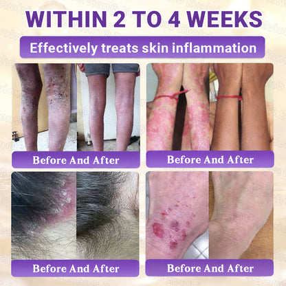 DermaVive – Biotin 10-in-1 Hauterneuerungscreme