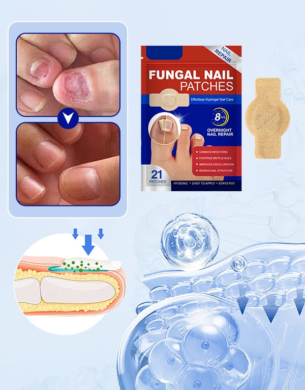 FungiCare – Fortschrittliche Nagelreparatur-Pflaster