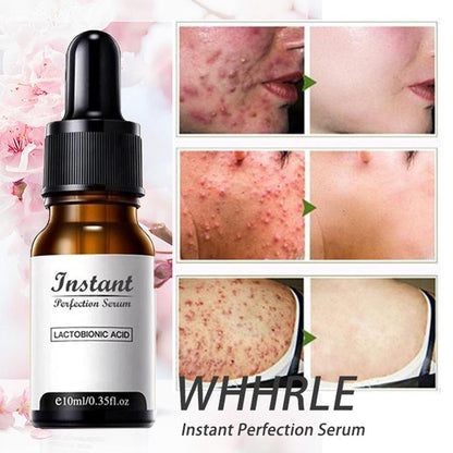 DermaYouth – Argireline Anti-Aging-Formel