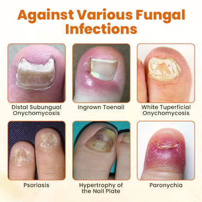 VenomNail Care – Fórmula de reparación profunda y protección