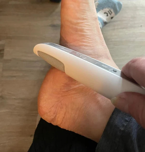 SoleSmooth - Electric Foot Callus Remover