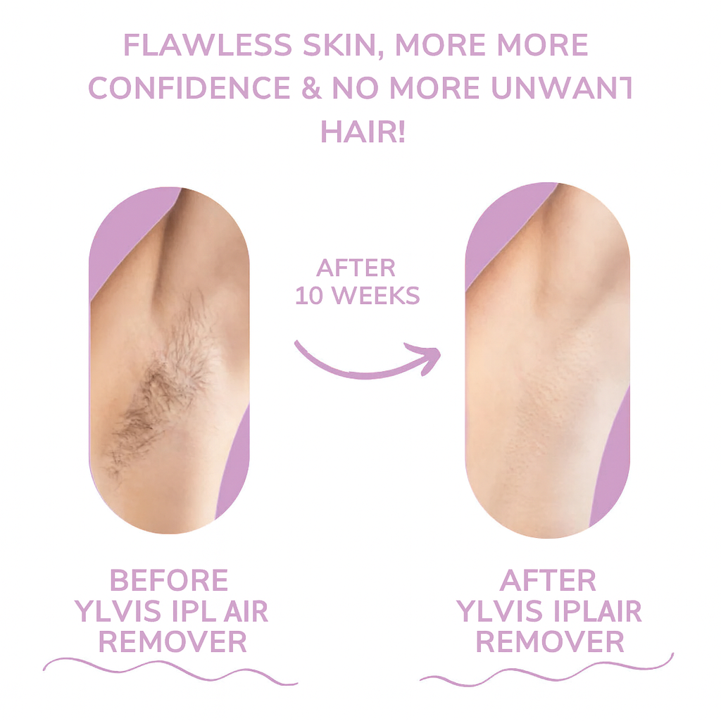 GlowEase - Depiladora IPL para una Piel Suave sin Esfuerzo