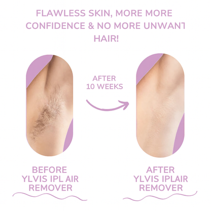GlowEase - Depiladora IPL para una Piel Suave sin Esfuerzo