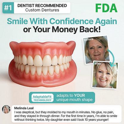 SmileLock – Solución premium de prótesis dentales completas
